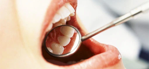  комплексное лечение зубов 