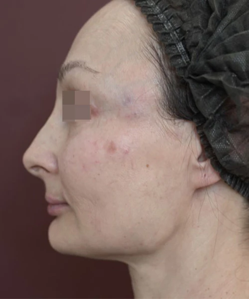 Клинический результат