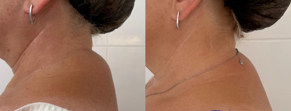 Light Fit Peptides Inside