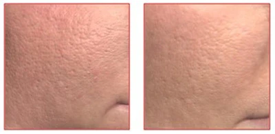 Ксеомин, исследование