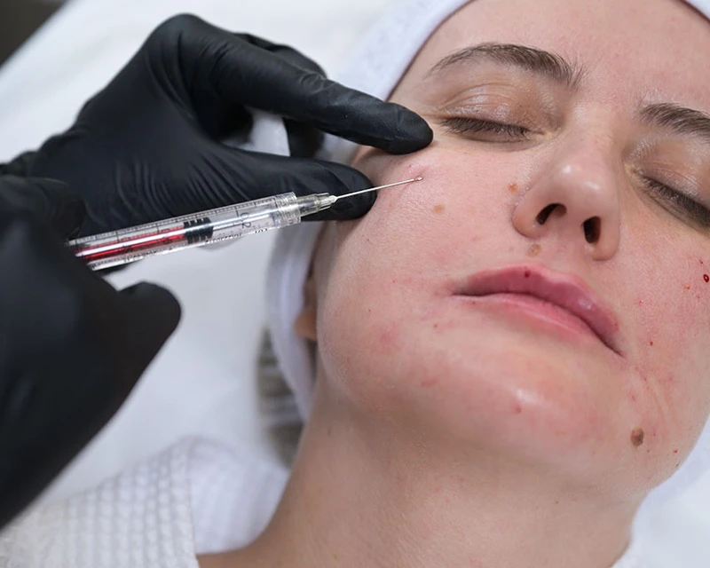 Neauvia Введение