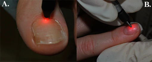 Демонстрация в работе манипулы