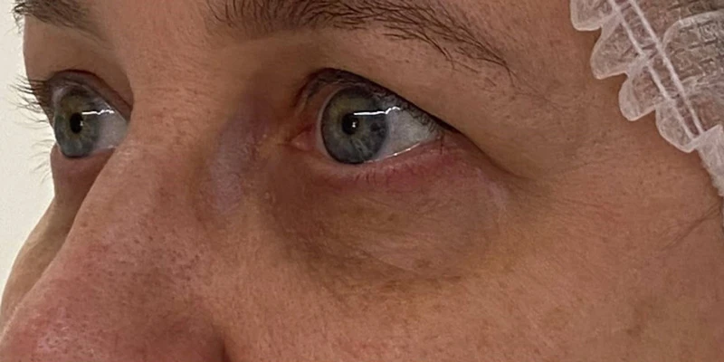 фракционный термолиз на аппарате CAPELLO CO2 Re:Flex, фото до