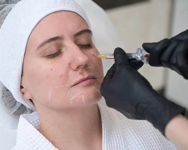 Neauvia Введение