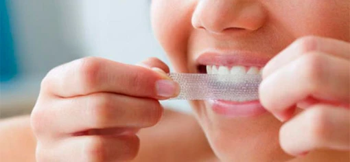 Белоснежная улыбка 