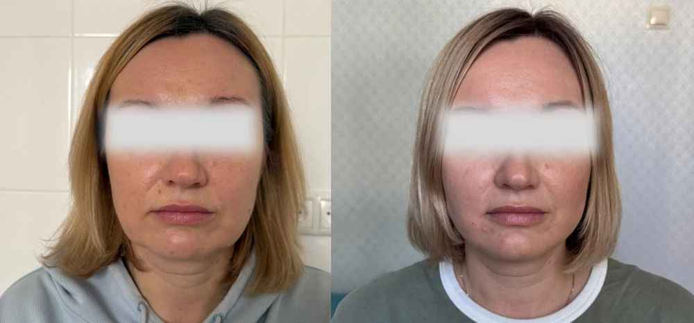 Light Fit Peptides Inside