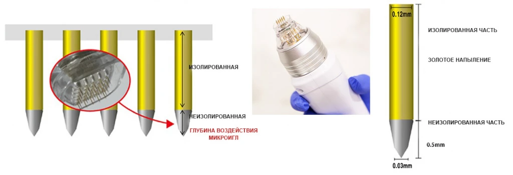 Аппарат INUS, схема зон золочения