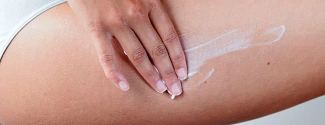 Реабилитационный период после склеротерапии