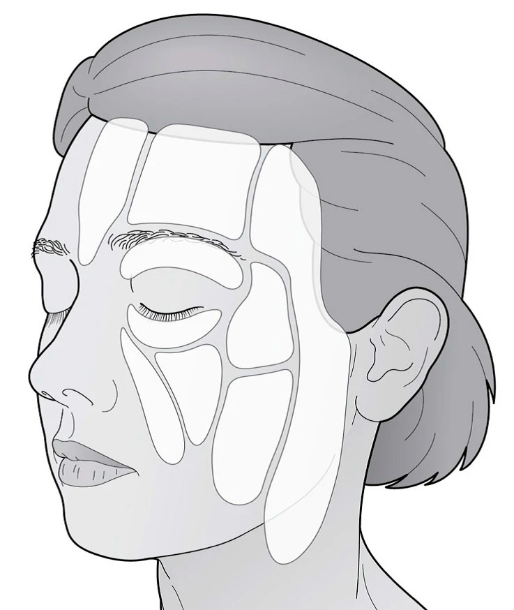 Подкожные жировые отложения