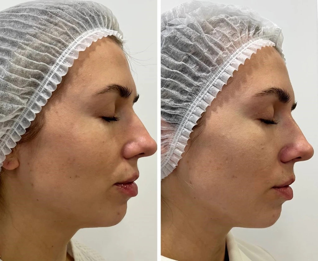 Calecim Professional Serum
