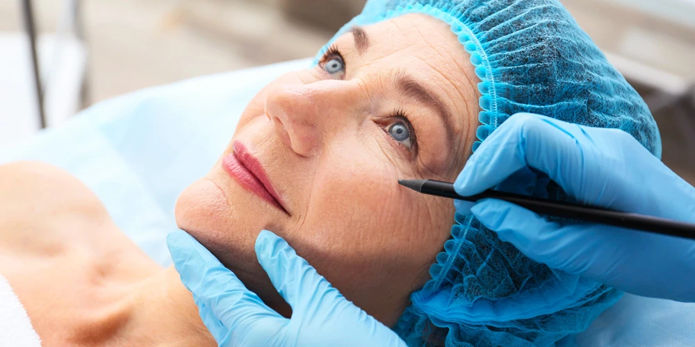 СМАС-лифтинг