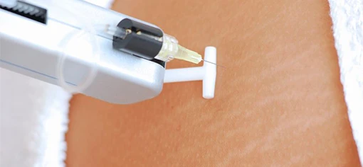 Лечение стрий