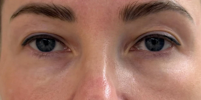 фракционный термолиз на аппарате CAPELLO CO2 Re:Flex, фото после