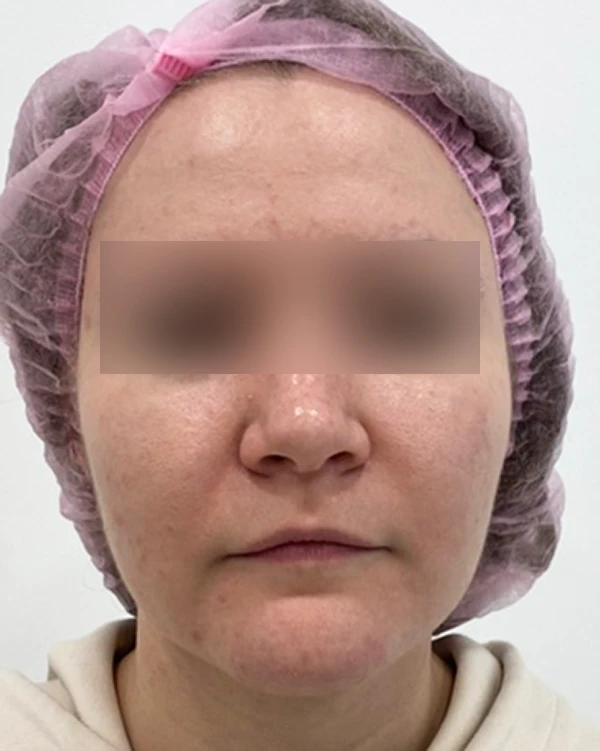 Skin Longevity