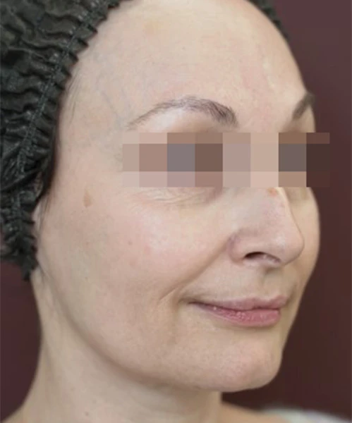 Пациент до процедуры