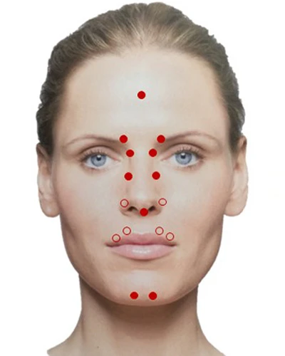 Разведение Ксеомина