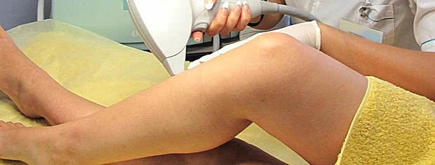 фотоэпиляция, электроэпиляция