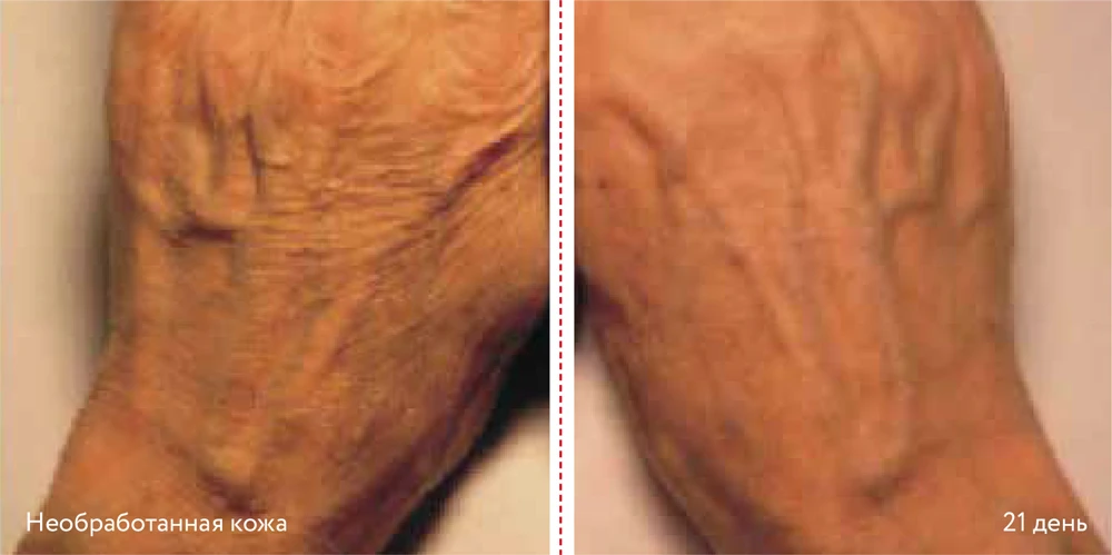 DERMADROP