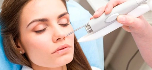 Сосудистые звездочки 