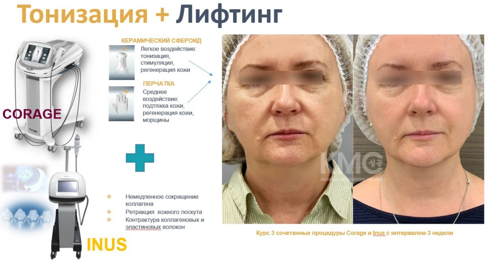Сочетаемость аппаратных технологий