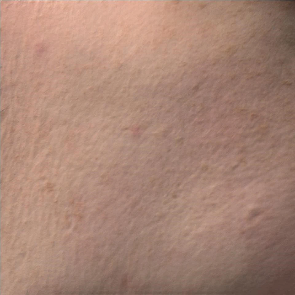 до и после проведенного курса Геля PRX-T33