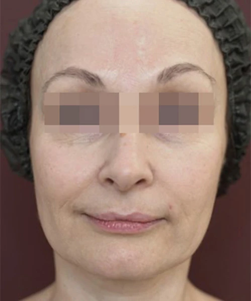 Пациент до процедуры