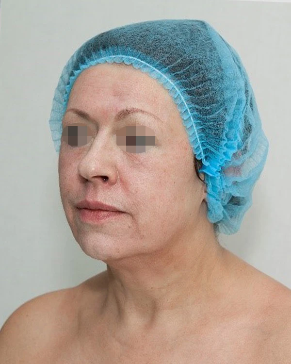 Аминокислотно-заместительная терапия препаратом Jalupro®