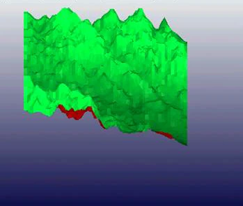 поверхность кожи до проведения инъекционного курса АЗТ Jalupro®