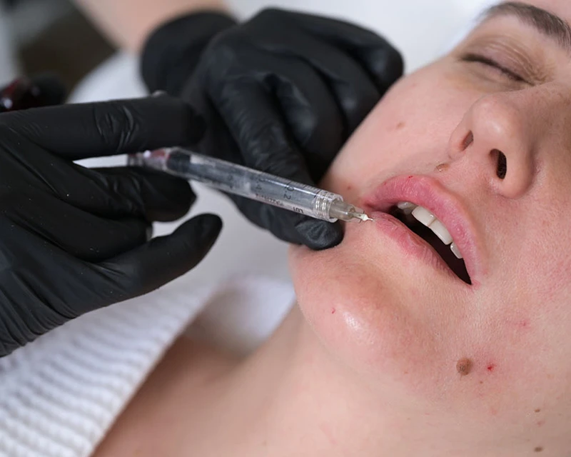 Neauvia Введение