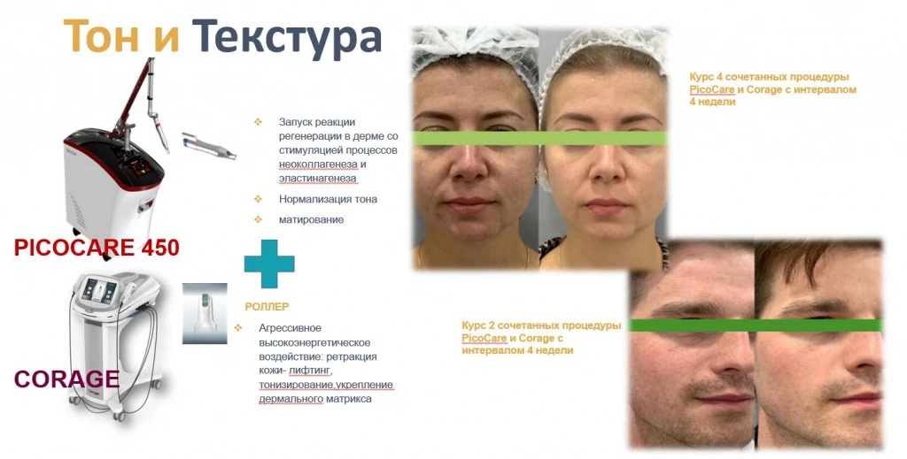 Сочетаемость аппаратных технологий