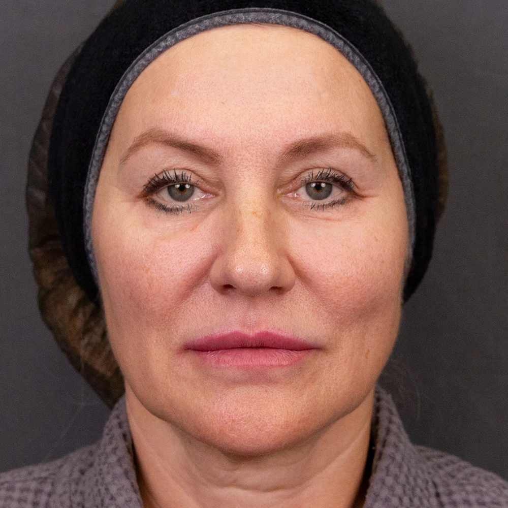 Клинический случай, Протокол Skin Glow