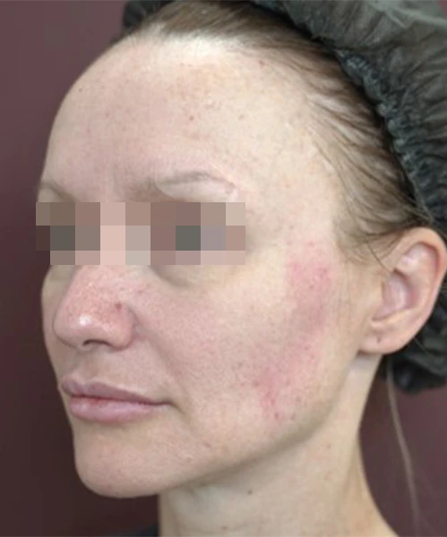 Клинический результат