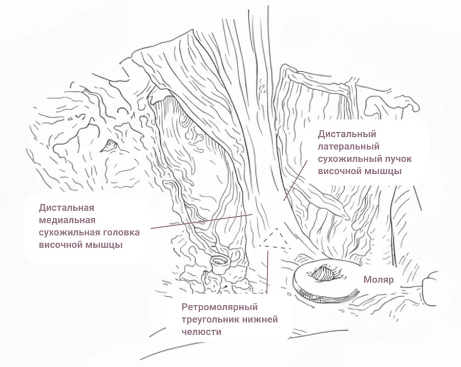 Контроверсии вокруг m. temporalis
