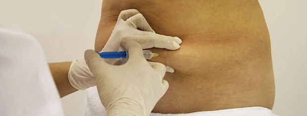 Протокол мезокоррекции локальных жировых отложений