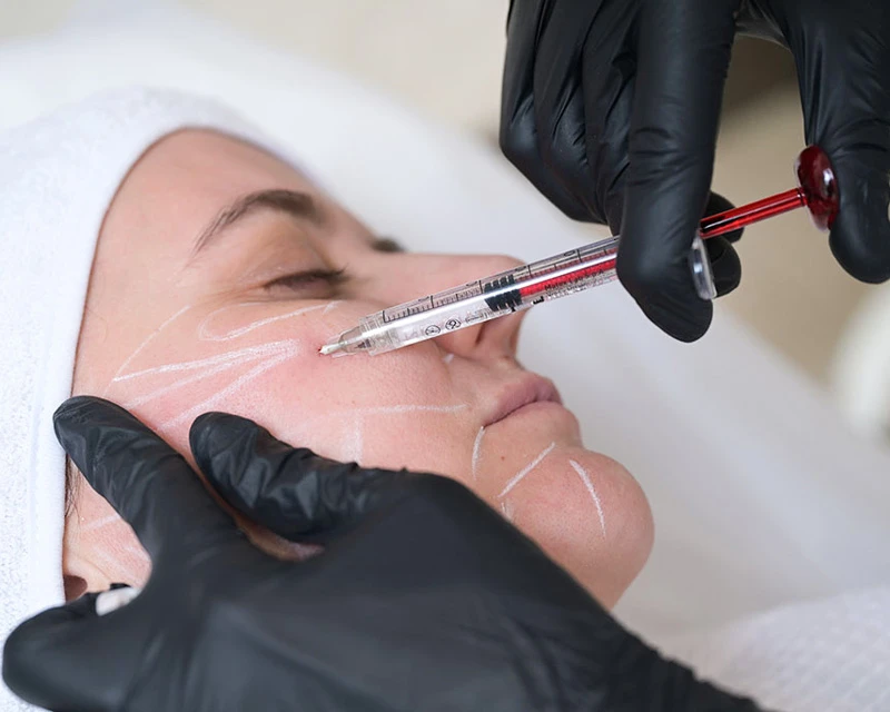 Neauvia Введение