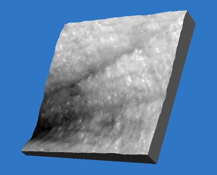 Фото 3D после проведения процедуры HELEO4