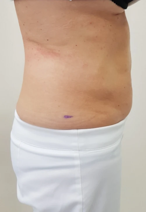 ulfit фото после