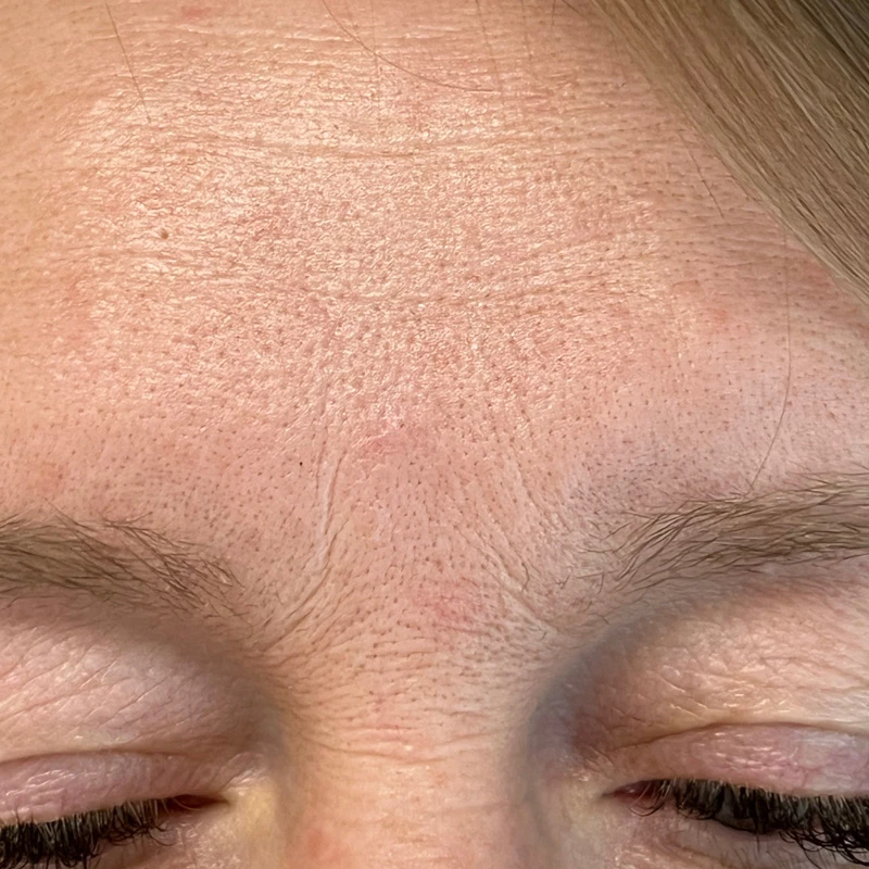 Водородный гидропилинг Hydra Touch H2