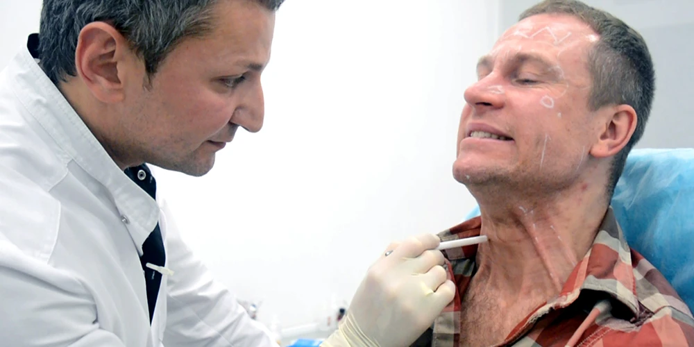 Ботулотоксин у мужчин