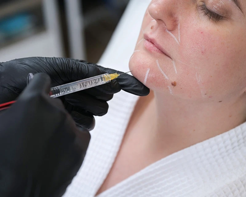 Neauvia Введение