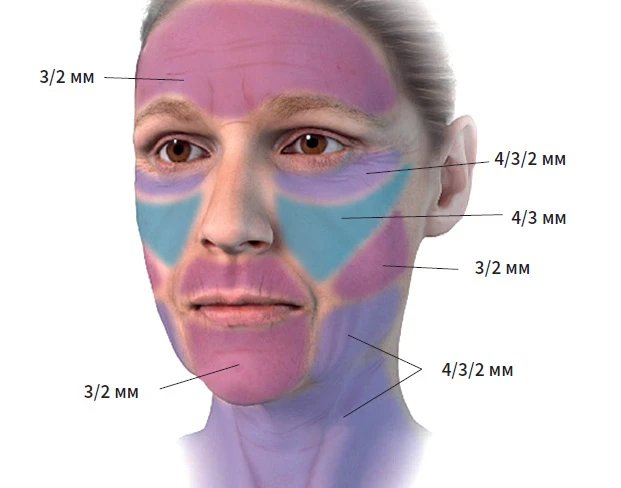 Параметры работы Morpheus 8