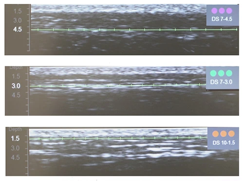 Диагностическая визуализация щёчной, периоральной и периорбитальной зон