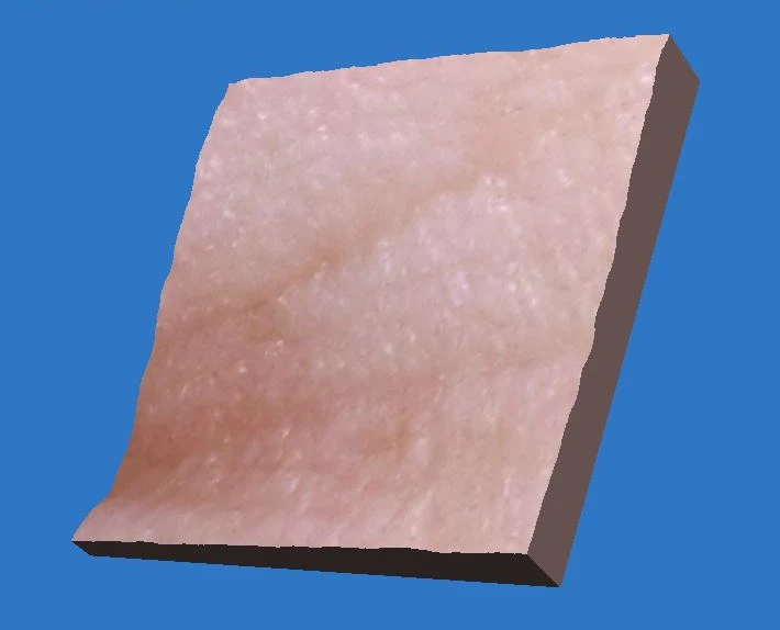 Фото 3D после проведения процедуры HELEO4