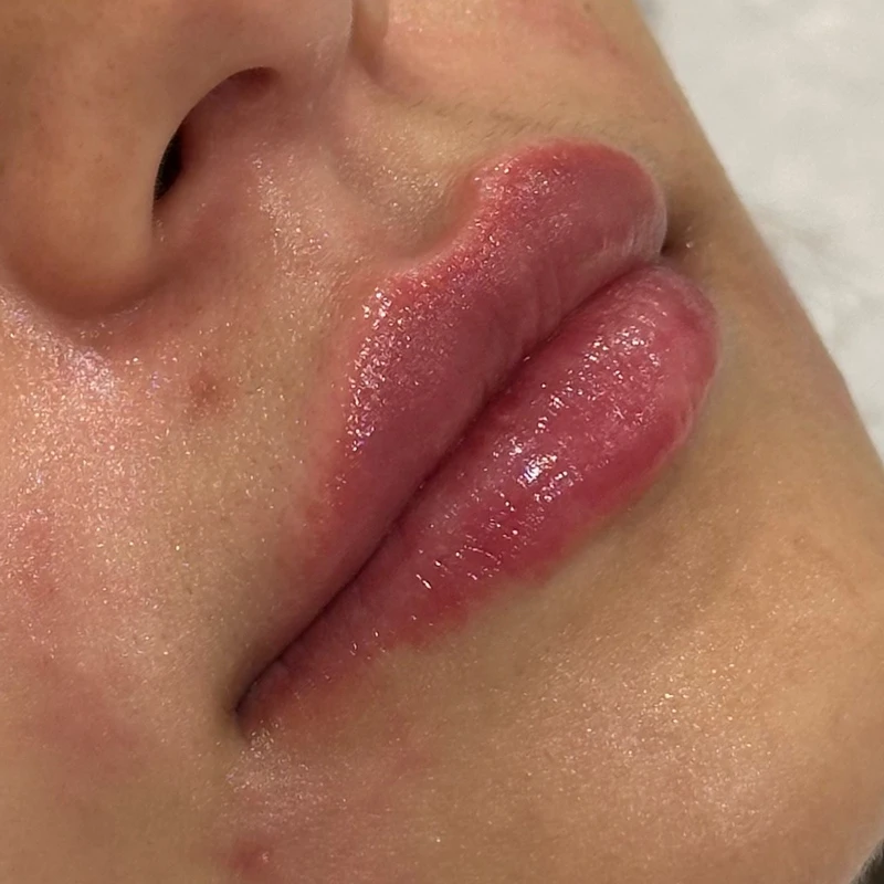 Hyafilia Mold, после
