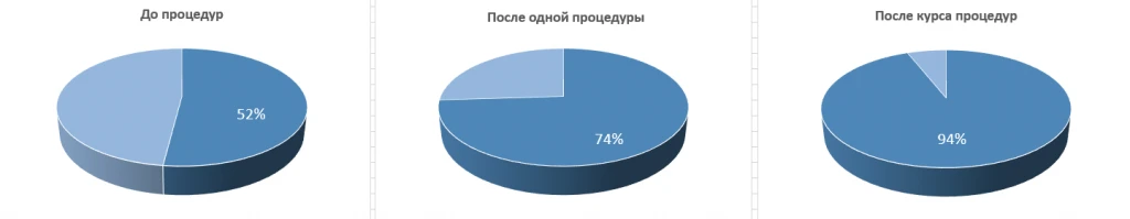 Аппарат INUS. Наличие морщин