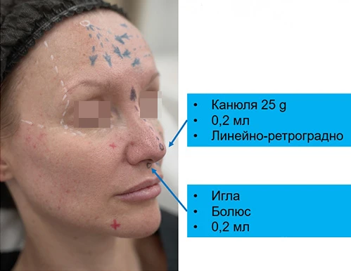 Диагностическая визуализация