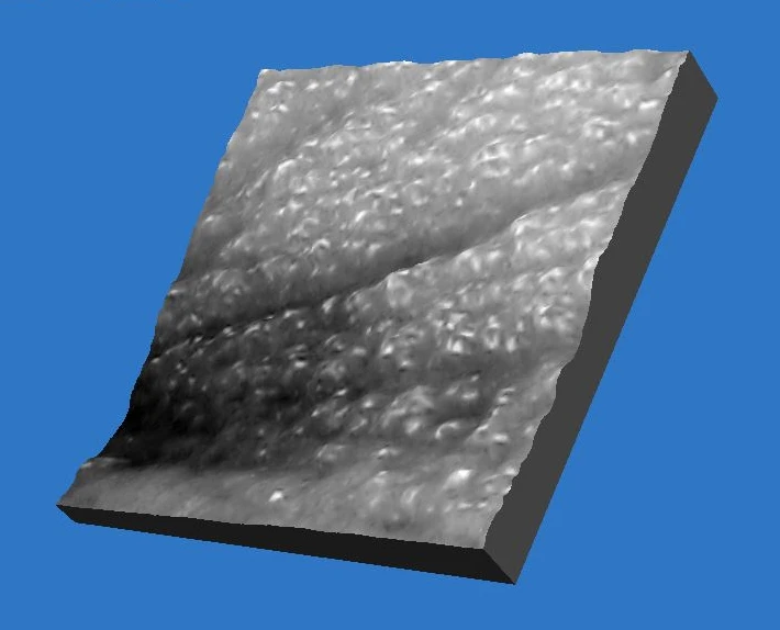 Фото 3D до проведения процедуры HELEO4