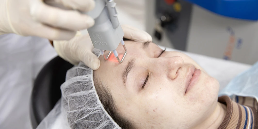 DOT-терапия SmartXide2 Deka, постакне