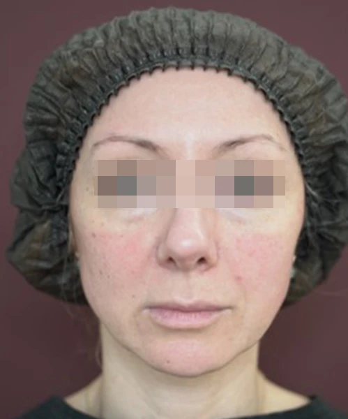 Клинический результат