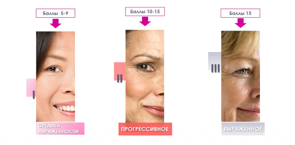 Степень выраженности старения